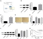 NUSAP1 Antibody in Western Blot, Immunohistochemistry (WB, IHC)
