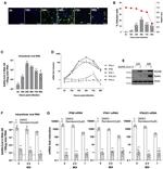 IFIT1 Antibody in Western Blot (WB)