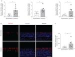 MUC5AC Antibody in Immunohistochemistry (IHC)