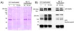 SARS/SARS-CoV-2 Nucleocapsid Antibody in Western Blot (WB)