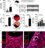 Cardiac Troponin T Antibody in Immunohistochemistry, Immunocytochemistry (IHC, ICC/IF)