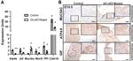 MUC5AC Antibody in Immunohistochemistry (IHC)