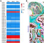 KGF Antibody in Immunohistochemistry (IHC)