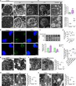 MMP9 Antibody in Immunohistochemistry (IHC)