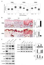 Cytokeratin 5 Antibody in Western Blot (WB)