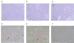 ErbB2 (HER-2) Antibody in Immunohistochemistry (IHC)