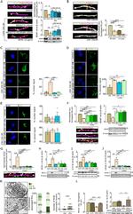 Phospho-NFkB p65 (Thr435) Antibody in Immunohistochemistry (IHC)