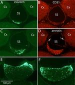 S-arrestin Antibody in Immunohistochemistry, Immunocytochemistry (IHC, ICC/IF)