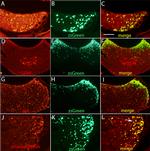 S-arrestin Antibody in Immunohistochemistry, Immunocytochemistry (IHC, ICC/IF)