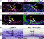 CHD7 Antibody in Immunohistochemistry (IHC)