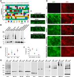 EPB41L2 Antibody in Western Blot (WB)