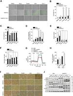 4-Hydroxynonenal Antibody in Western Blot (WB)