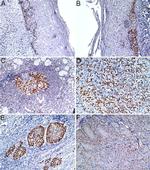 MCM7 Antibody in Immunohistochemistry (IHC)