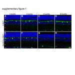Calbindin D28K Antibody in Immunohistochemistry, Immunocytochemistry (IHC, ICC/IF)
