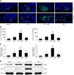 CD4 Antibody in Western Blot (WB)