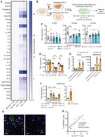 IL-18 Antibody in Neutralization (Neu)