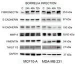 MMP9 Antibody in Western Blot (WB)
