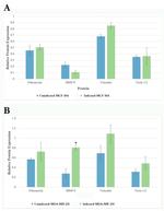 MMP9 Antibody in Western Blot (WB)