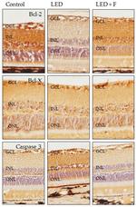 Caspase 3 Antibody in Immunohistochemistry (IHC)