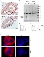Collagen I Antibody in Immunohistochemistry (IHC)