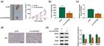 HK2 Antibody in Western Blot (WB)
