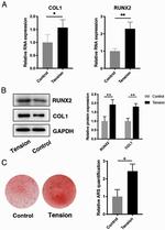 COL1A1 Antibody in Western Blot (WB)