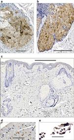 CIDEA Antibody in Immunohistochemistry (IHC)