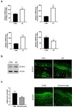 ELOVL1 Antibody in Western Blot (WB)