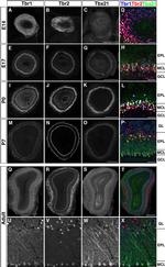 EOMES Antibody in Immunohistochemistry, Immunocytochemistry (IHC, ICC/IF)