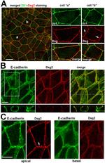 Desmoglein 2 Antibody in Immunocytochemistry (ICC/IF)