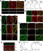 Desmoglein 2 Antibody in Immunocytochemistry (ICC/IF)