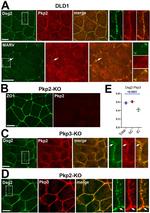 Desmoglein 2 Antibody in Immunocytochemistry (ICC/IF)