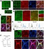 Desmoglein 2 Antibody in Immunocytochemistry (ICC/IF)