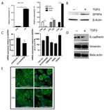 Vimentin Antibody in Western Blot (WB)