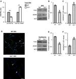 FUS Antibody in Western Blot (WB)