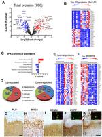 ENPP2 Antibody in Immunohistochemistry (IHC)