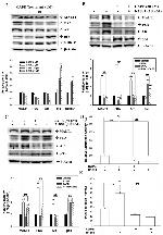 NDRG1 Antibody in Western Blot (WB)