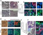 MUC2 Antibody in Immunohistochemistry (IHC)