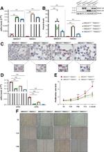 TM6SF2 Antibody in Western Blot (WB)