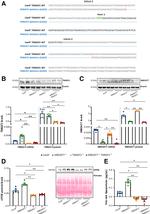 TM6SF2 Antibody in Western Blot (WB)