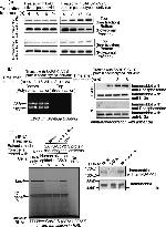 DAPK1 Antibody in Western Blot (WB)
