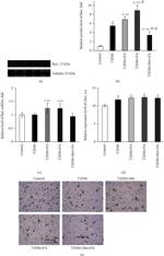 IBA1 Antibody in Immunohistochemistry (Paraffin) (IHC (P))
