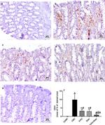 CD31 Antibody in Immunohistochemistry (IHC)