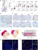 IL-8 (CXCL8) Antibody in Immunohistochemistry (IHC)