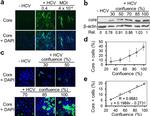 Hepatitis C Virus Core Antigen Antibody in Flow Cytometry (Flow)
