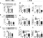 S100A11 Antibody in Western Blot (WB)