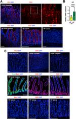 CDX2 Antibody in Immunohistochemistry (IHC)