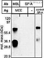 MBL2 Antibody in Western Blot (WB)
