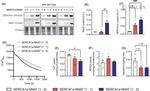 SERCA1 ATPase Antibody in Western Blot (WB)