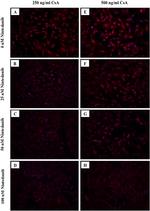 TGM2 Antibody in Immunocytochemistry (ICC/IF)
